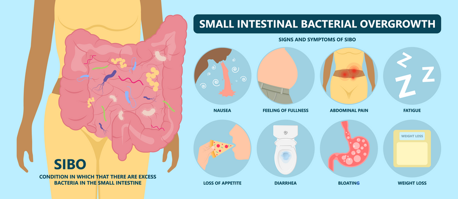 SIBO: What It Is and How It Affects Your Body: The Truth About Small Intestinal Bacterial Overgrowth